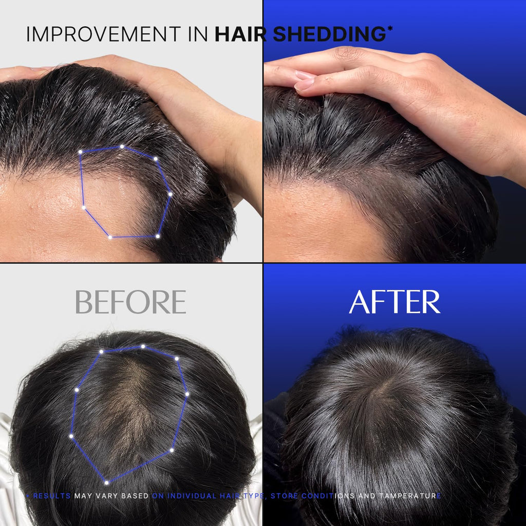 lilyeve GROWTURN Exosome Brush Ampoule Prime for Man, Built-in Brush, Heartleaf-Derived Exosomes to Revitalize, for Male Pattern Hair Loss, Korean Hair Care, 3.38 fl. oz.