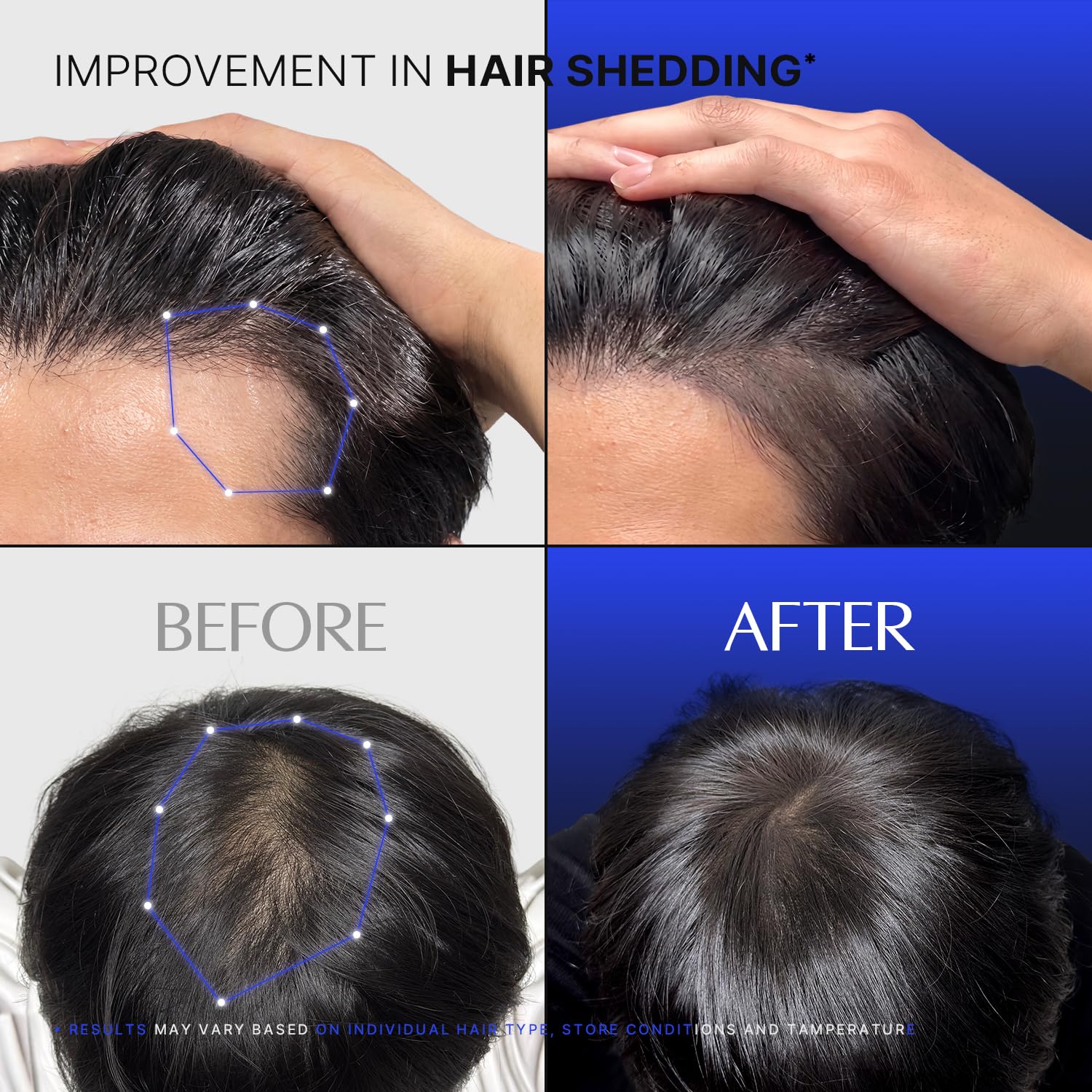 lilyeve GROWTURN Exosome Brush Ampoule Prime for Man, Built-in Brush, Heartleaf-Derived Exosomes to Revitalize, for Male Pattern Hair Loss, Korean Hair Care, 3.38 fl. oz.